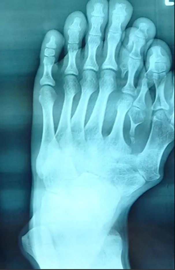 9 ngon tren ban chan anh 3