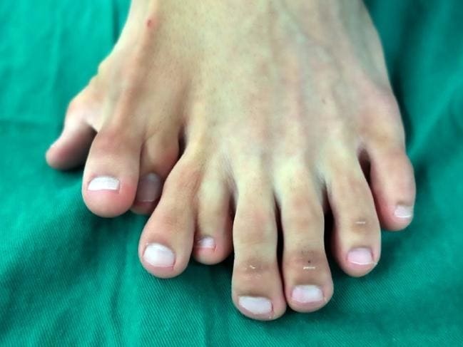 9 ngón trên bàn chân ảnh 1 9 ngon tren ban chan anh 1