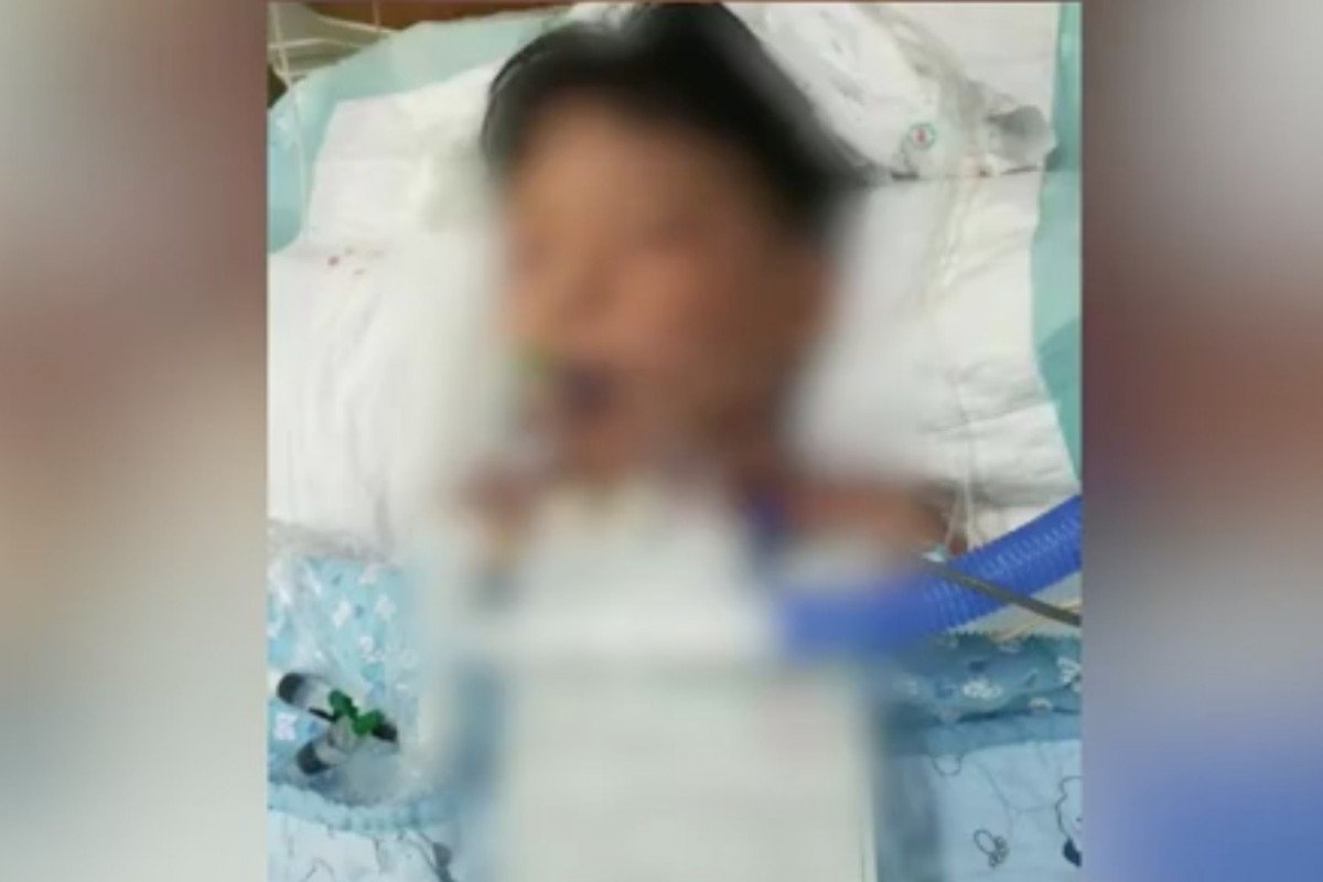 ngộ độc thực phẩm ảnh 1 ngo doc thuc pham anh 1