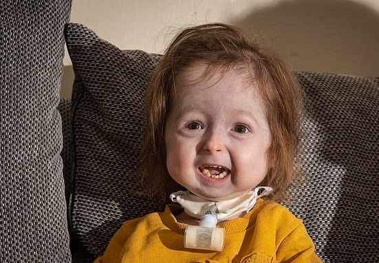 Be gai 2 tuoi co khuon mat nhu ba lao hinh anh