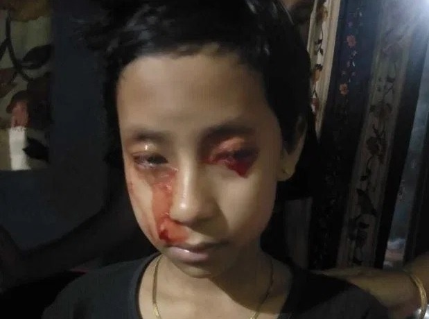 Be gai 8 tuoi ‘khoc' ra mau hinh anh