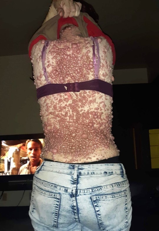 u soi than kinh anh 1