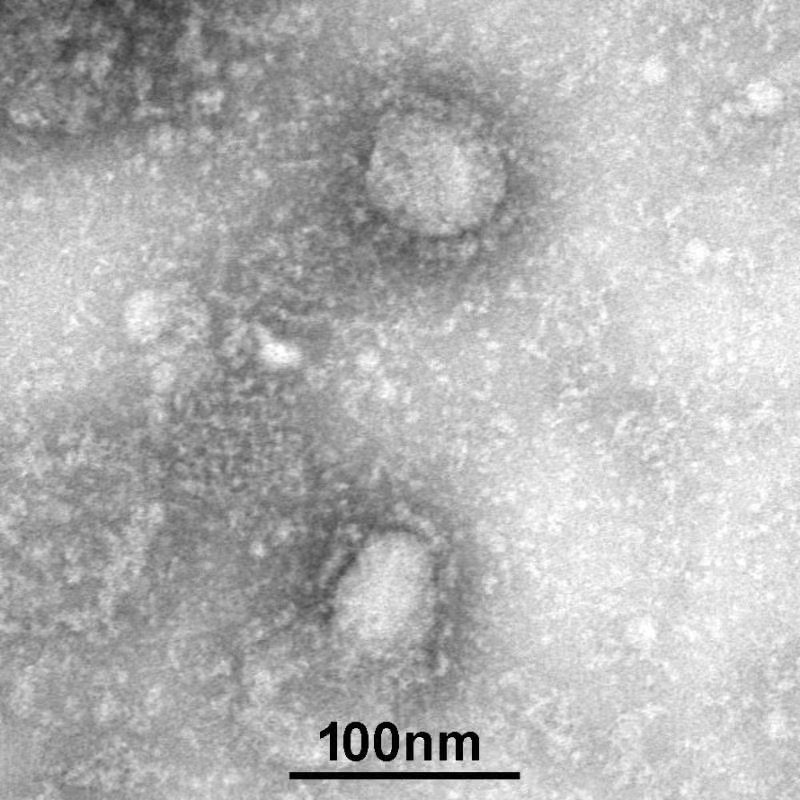 virus corona ảnh 1 virus corona anh 1