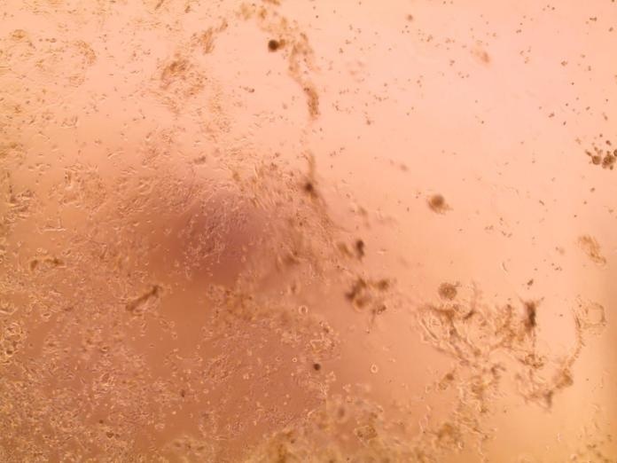 Chau Au lan dau nuoi cay thanh cong chung virus corona moi hinh anh