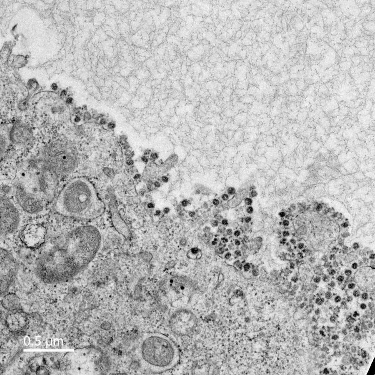 corona ảnh 1 corona anh 1