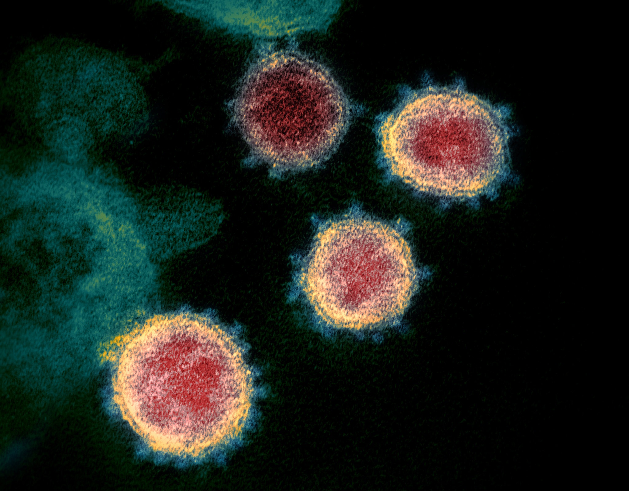 virus corona lây lan ảnh 4 virus corona lay lan anh 4