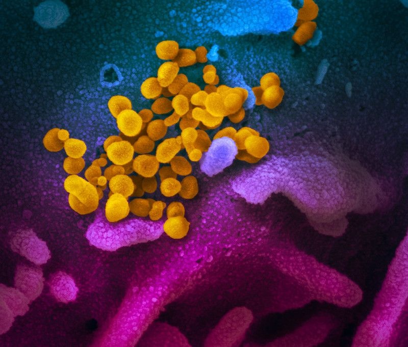 virus corona lây lan ảnh 2 virus corona lay lan anh 2