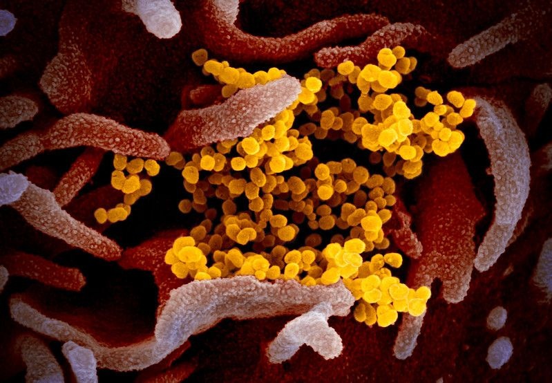 virus corona lây lan ảnh 1 virus corona lay lan anh 1