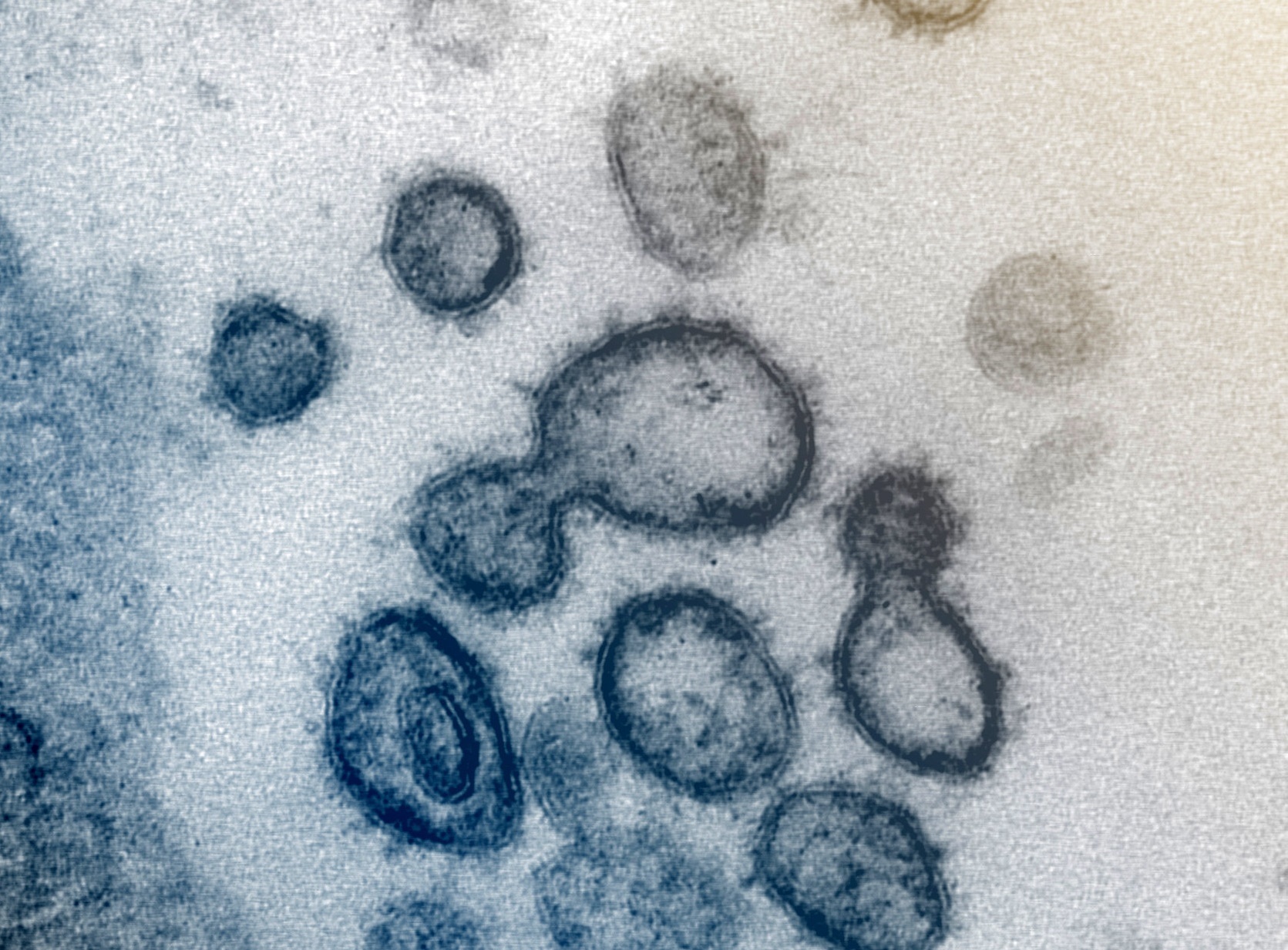 virus corona lây lan ảnh 2 virus corona lay lan anh 2