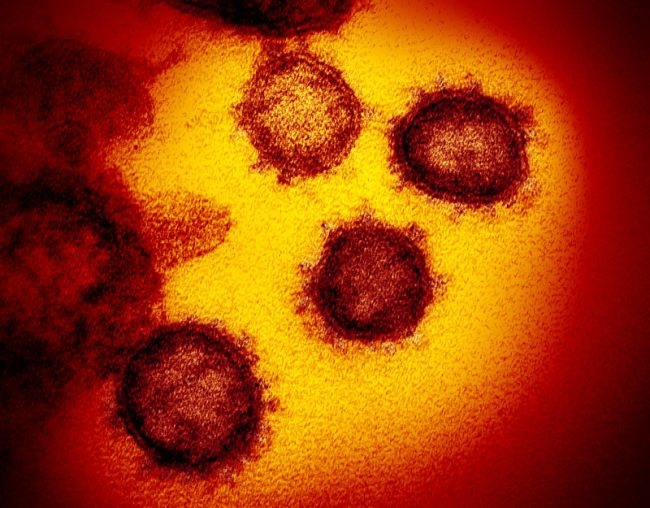 virus corona lây lan ảnh 3 virus corona lay lan anh 3