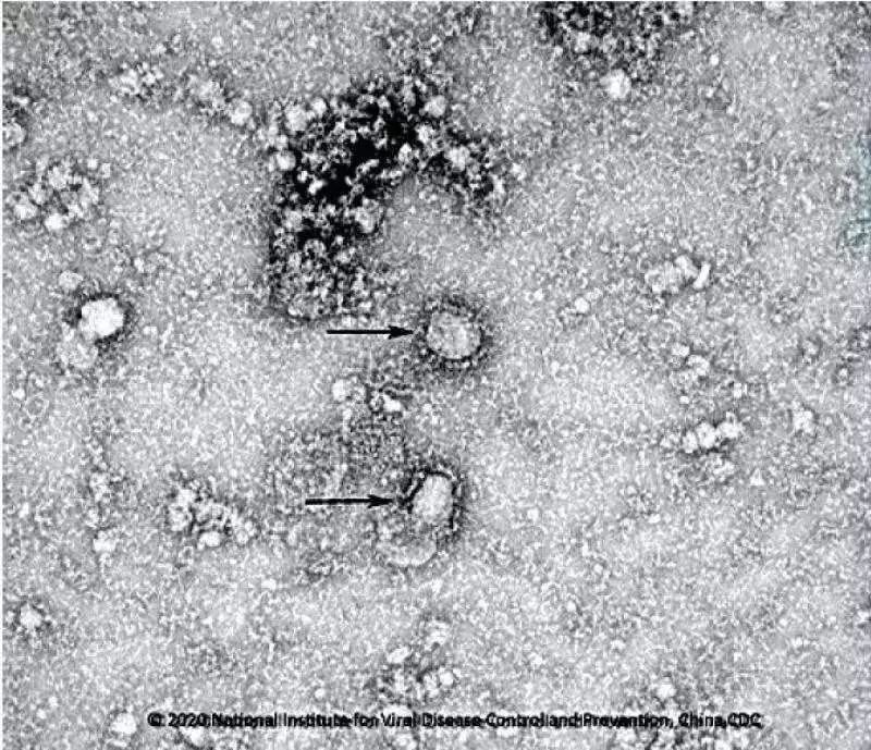 virus corona anh 1