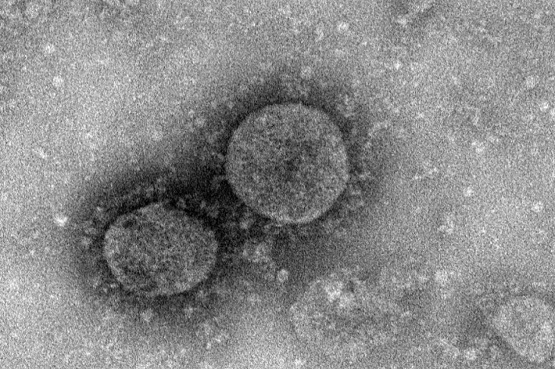 virus corona lan rộng ảnh 1 virus corona lan rong anh 1