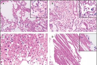 virus corona lan rộng ảnh 2 virus corona lan rong anh 2