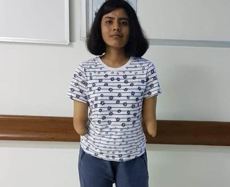 cấy ghép tay ảnh 1 cay ghep tay anh 1