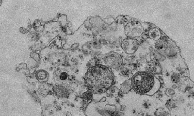 Phat hien cach thuc lay nhiem moi cua virus cum hinh anh