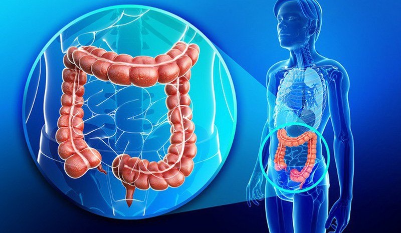 viêm đại tràng ảnh 4 viem dai trang anh 4