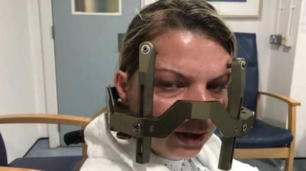 Thuong xuyen dau dau vi 16 khoi u ac tinh trong nao hinh anh