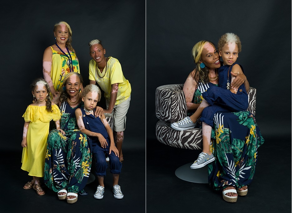 Bệnh lạ  ảnh 1 Benh la anh 1