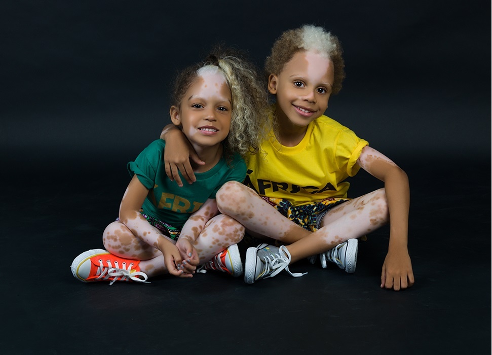 Mau nhi voi hanh trinh tu e che toi hanh dien vi 'mao' trang tren dau hinh anh