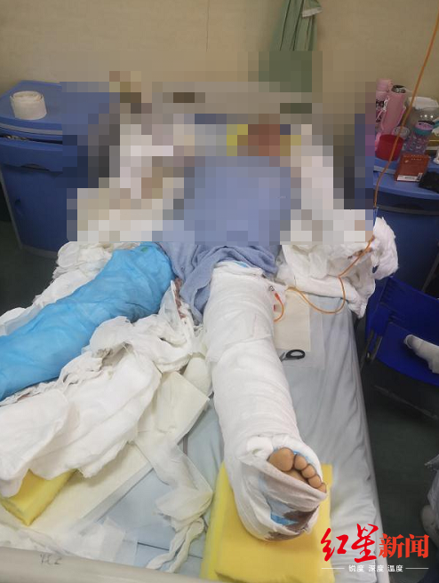 Bong nang vi no khi gas anh 1