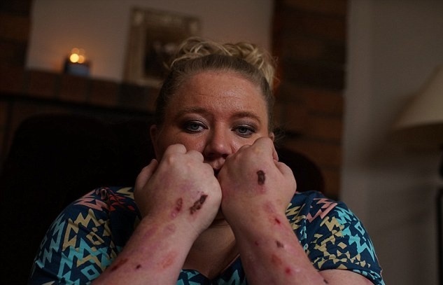 can benh dau don nhat the gioi anh 3