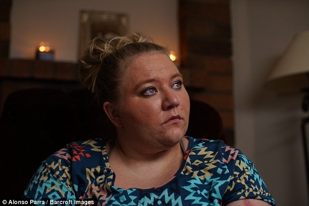 can benh dau don nhat the gioi anh 1