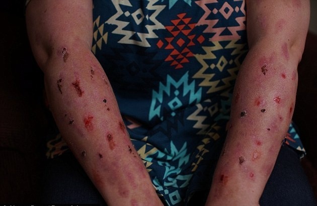 Nguoi phu nu mac can benh dau don nhat the gioi hinh anh