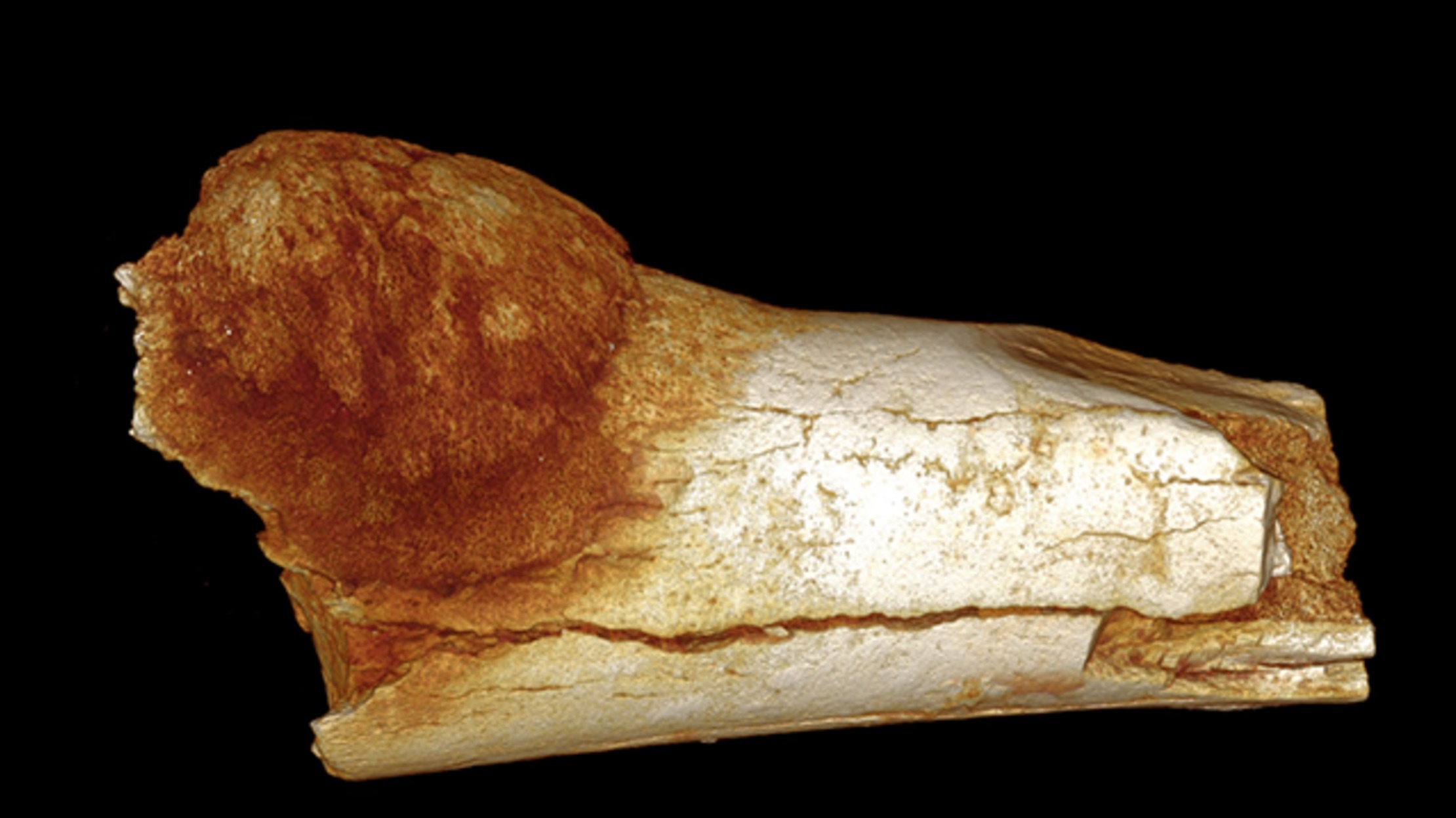 Te bao ung thu dau tien tren the gioi anh 1