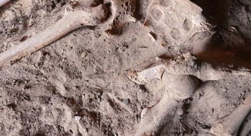 Phat hien bat ngo ve ung thu tu thoi co dai hinh anh