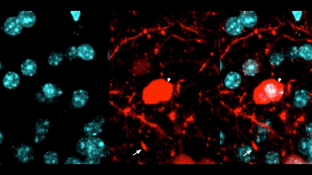Qua trinh nao bo don dep 'rac thai' trong he than kinh hinh anh