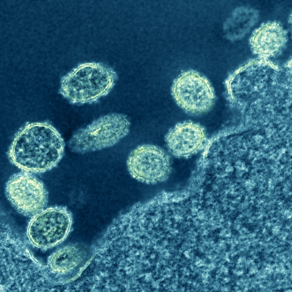 Virus cum heo anh 1