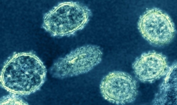 Chung virus cum moi duoc phat hien o Trung Quoc co nguy hiem? hinh anh