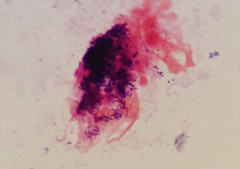 bien chung bach hau anh 1