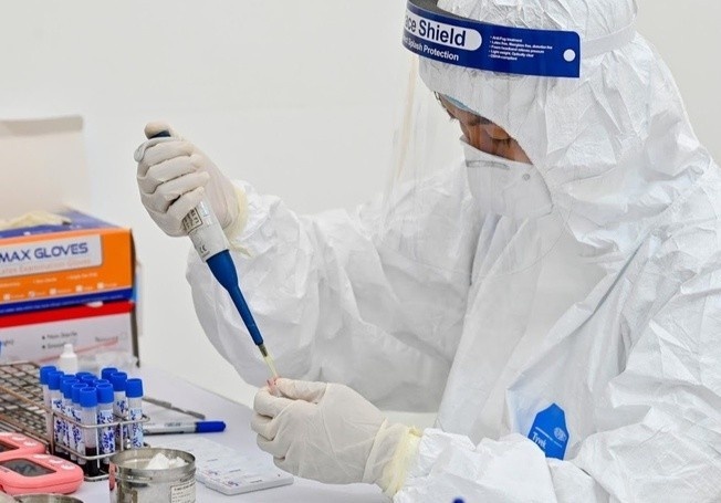 xét nghiệm Covid-19  ảnh 1 xet nghiem Covid-19 anh 1