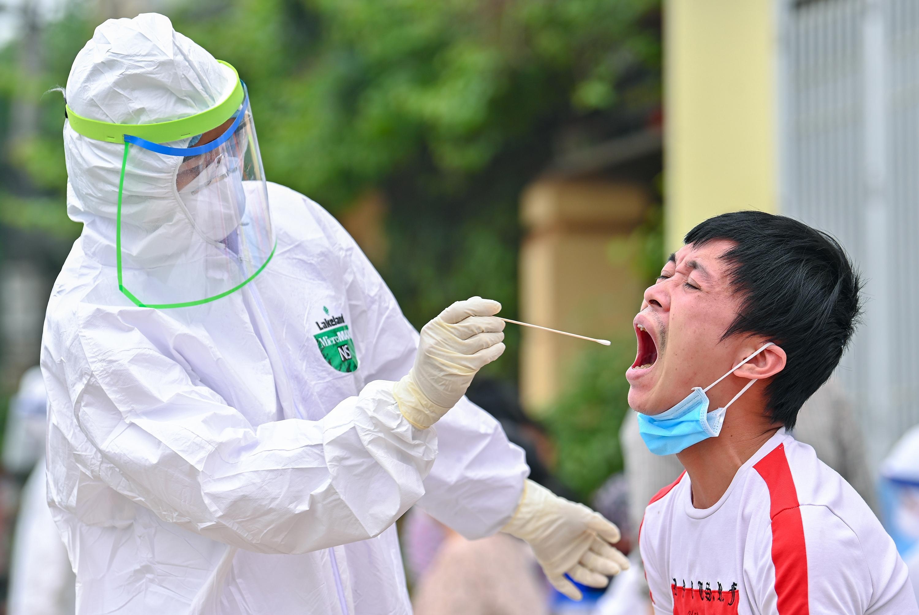 Xét nghiệm nhóm ảnh 1 Xet nghiem nhom anh 1