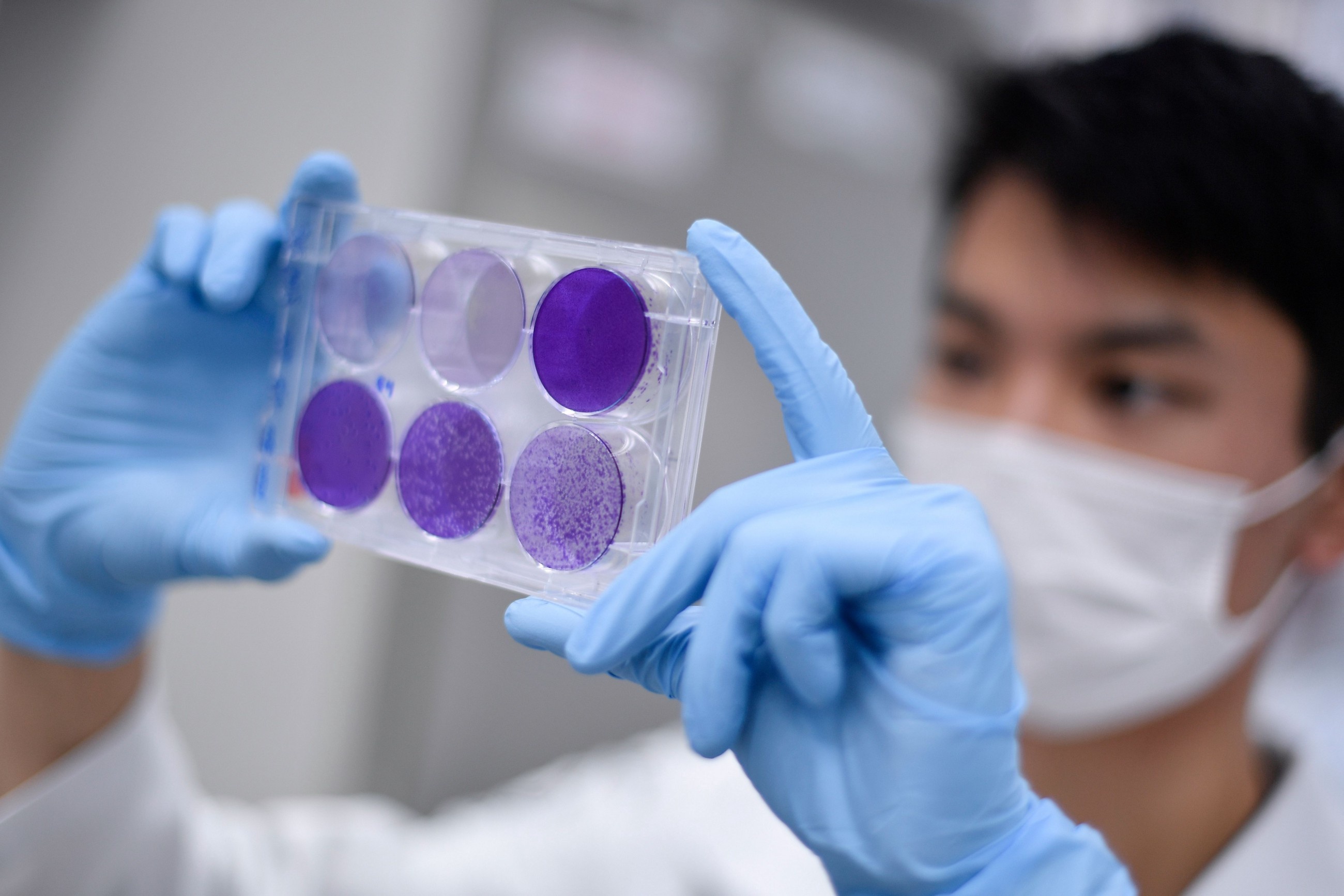 Vaccine Covid-19 ảnh 2 Vaccine Covid-19 anh 2