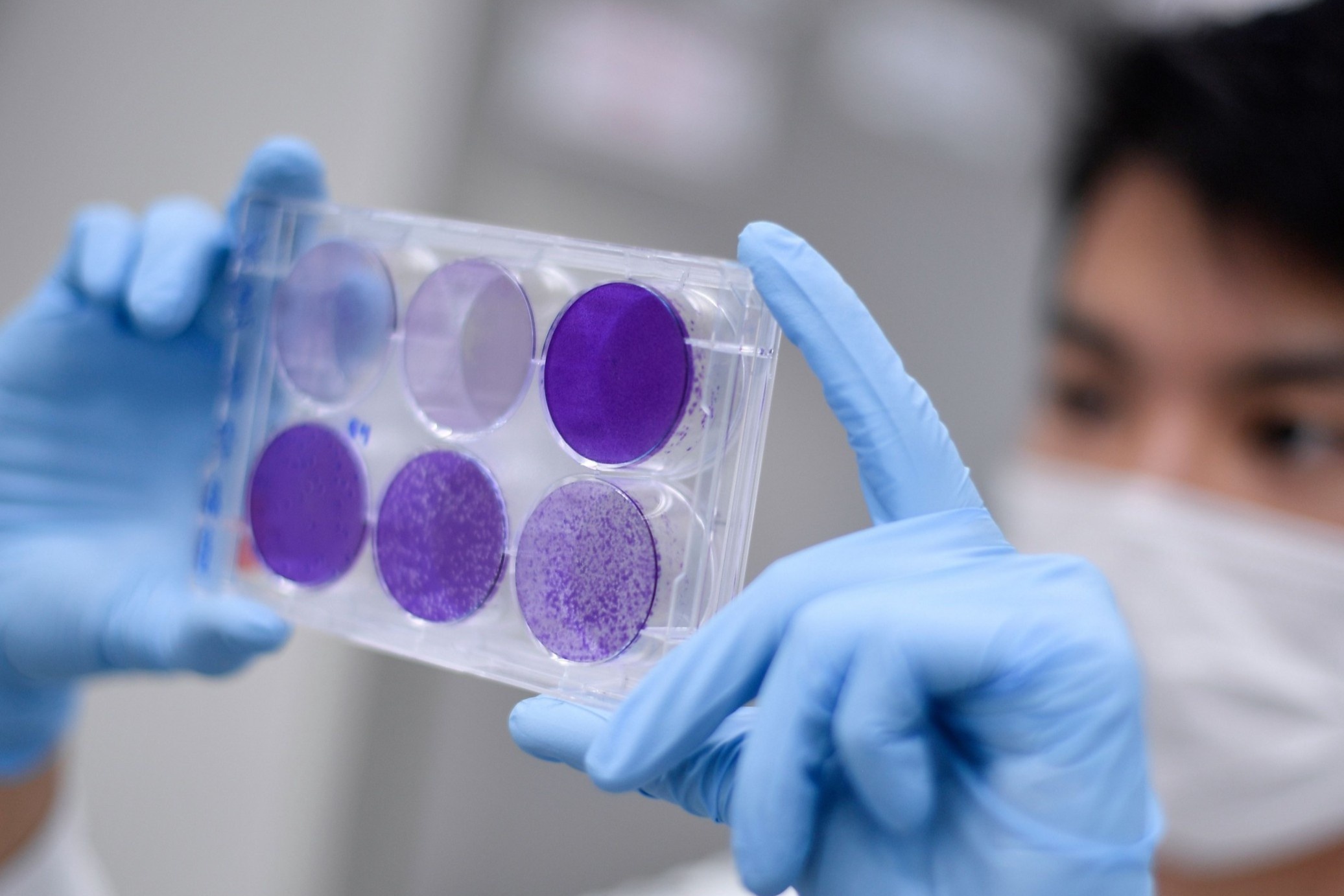 Vi sao san xuat vaccine can nhieu thoi gian? hinh anh