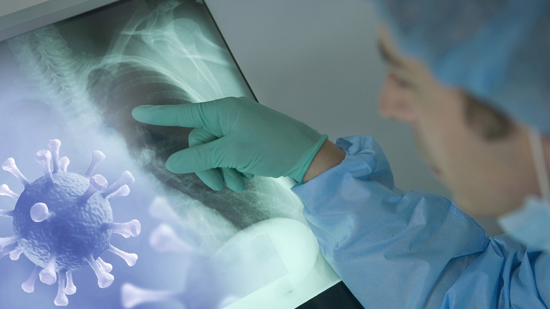 Hinh anh phoi nguoi mac Covid-19 o Viet Nam hinh anh