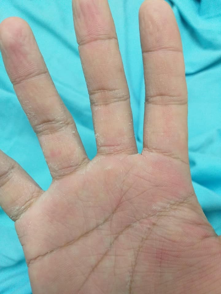 Bệnh viện Đa khoa Trung ương Quảng Nam ảnh 3 Benh vien Da khoa Trung uong Quang Nam anh 3