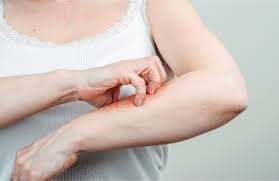 Phat hien ca mac dich hach tai My hinh anh