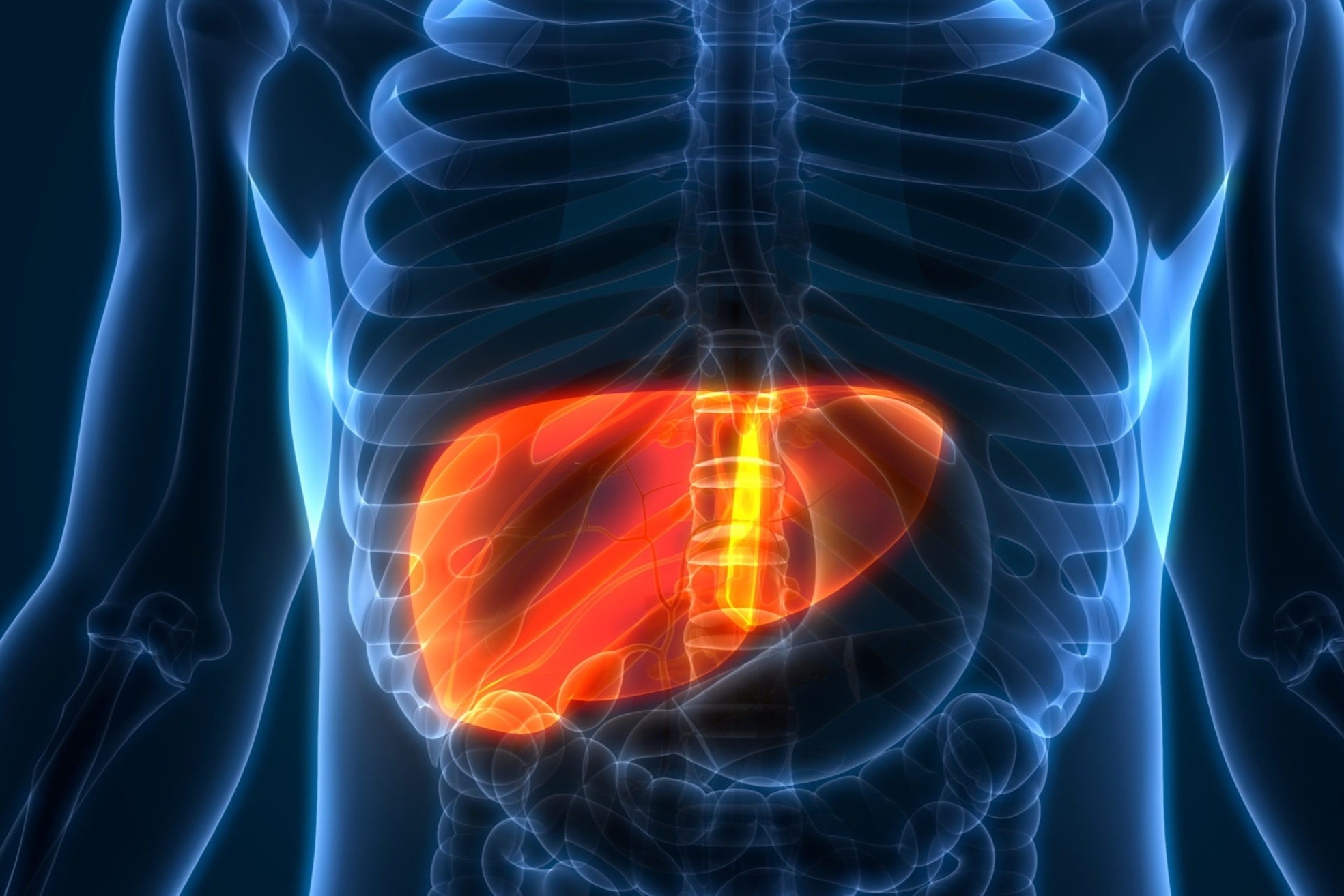 3 dieu can biet ve ung thu gan hinh anh