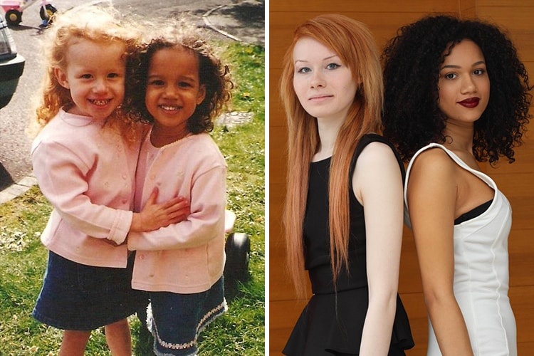 Cap sinh doi nguoi Anh khac biet hoan toan ve ngoai hinh hinh anh