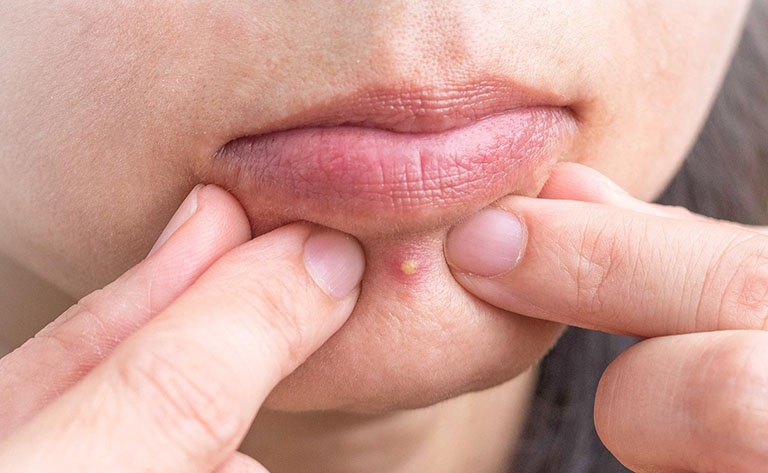 Vi tri noi mun canh bao dieu gi ve suc khoe? hinh anh