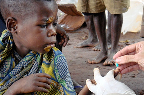 Can benh gay ton thuong xuong vinh vien o tre em hinh anh