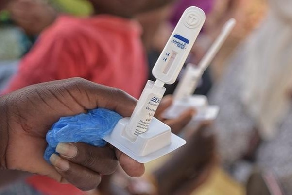 Tim ra tac dung moi cua thuoc khang virus HIV hinh anh