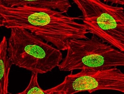 Phat hien phuong phap giup thu nho khoi u ac tinh hinh anh