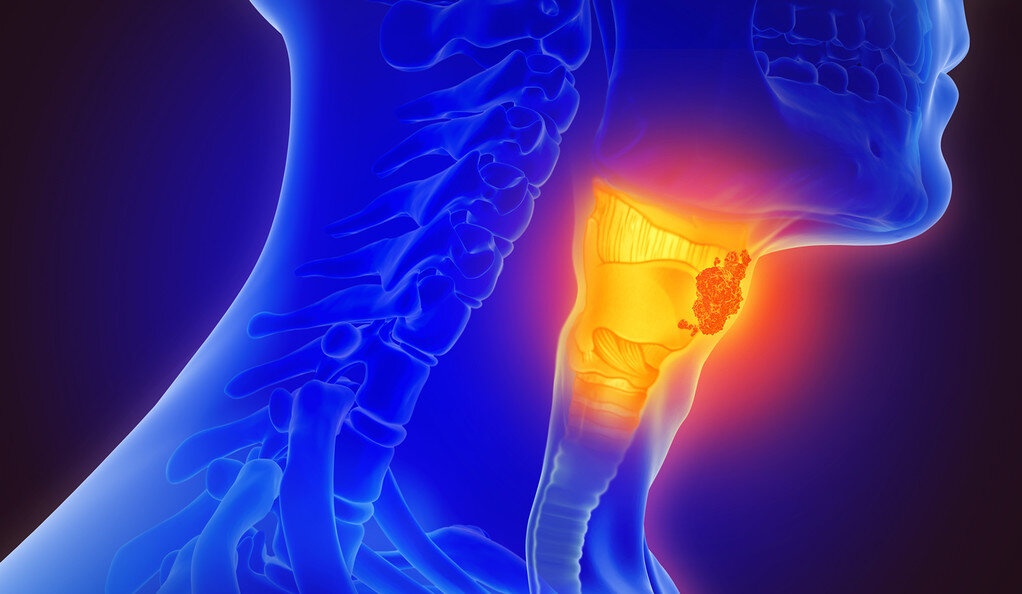 Australia tim ra cach chan doan ung thu bang hoi tho hinh anh