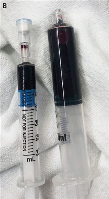 chung hiem gap anh 1