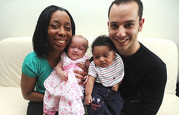 sinh doi khac mau da anh 3