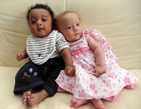 sinh doi khac mau da anh 4